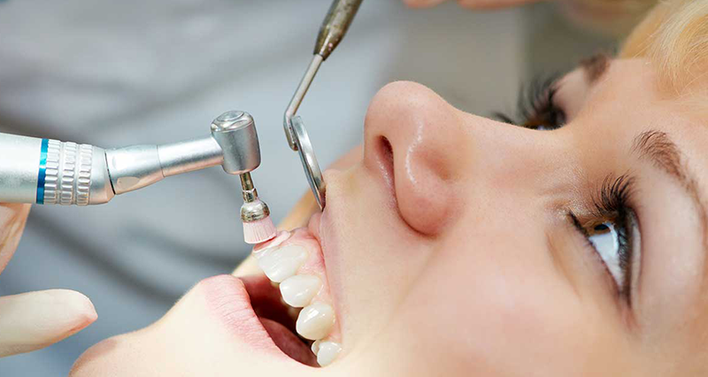 Dental Polishing